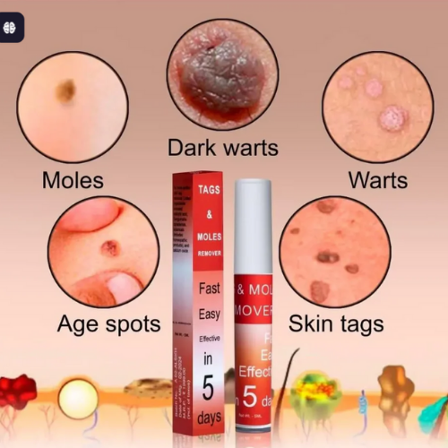 DermaCare™ Skin Spot Care Cream - Gentle care. Confident skin.