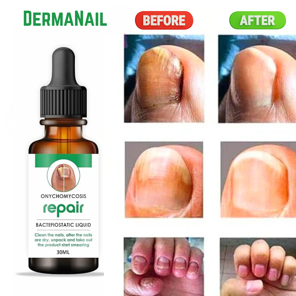 DermaNail™ - Nail Restore Oil