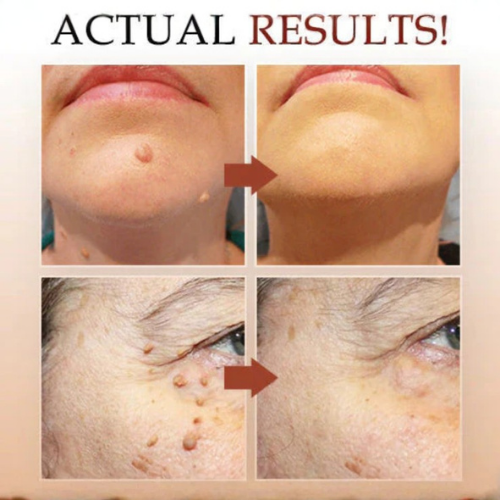 DermaCare™ Skin Spot Care Cream - Gentle care. Confident skin.