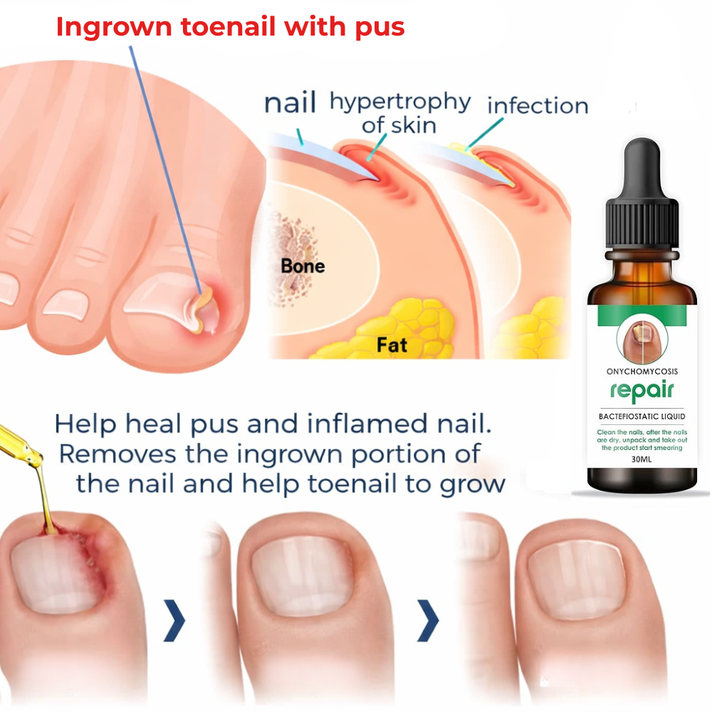 DermaNail™ - Nail Restore Oil