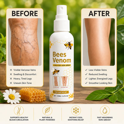 VeinEase™ - Leg Comfort Spray (Buy 1 Get 1)